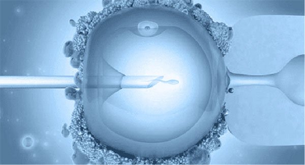 Женское бесплодие не приговор