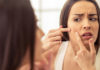 Проблемная кожа лица: чем поможет косметология