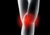 Почему болят колени: основные причины дискомфорта и способы избавления от них