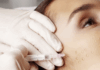 Биоревитализация: секрет молодой и увлажненной кожи